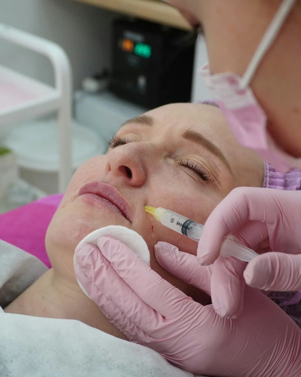 Mesoterapia